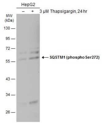Western Blot: p62/SQSTM1 [p Ser272] Antibody [NBP3-13316] - Untreated (-) and treated (+) HepG2 whole cell extracts (30 ug) were separated by 10% SDS-PAGE, and the membrane was blotted with SQSTM1 (phospho Ser272) antibody (NBP3-13316) diluted at 1:500. The HRP-conjugated anti-rabbit IgG antibody (NBP2-19301) was used to detect the primary antibody, and the signal was developed with Trident ECL plus-Enhanced.